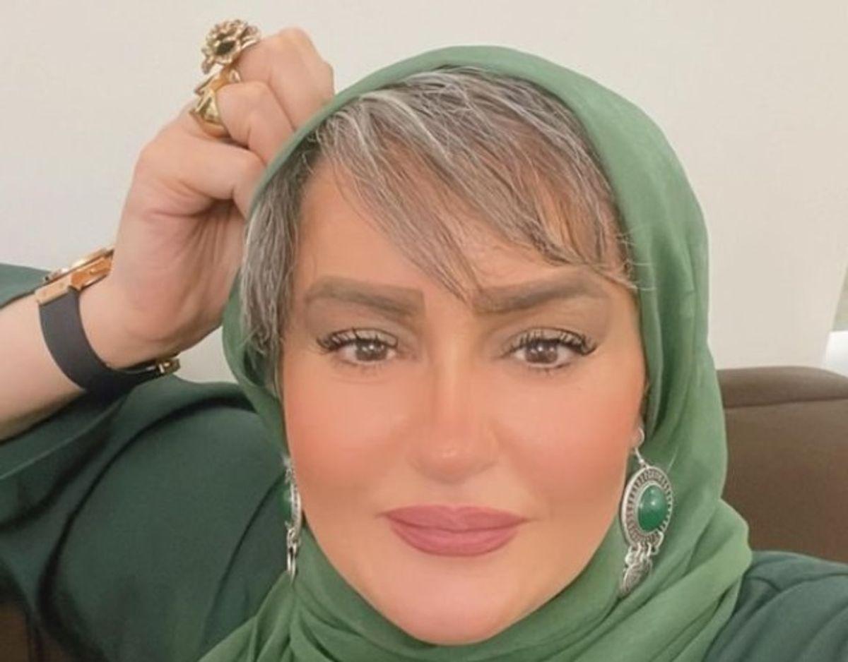 چهره جدید نعیمه نظام دوست | جراحی‌های لاغری روی خانم بازیگر موفقیت آمیز نبود +عکس